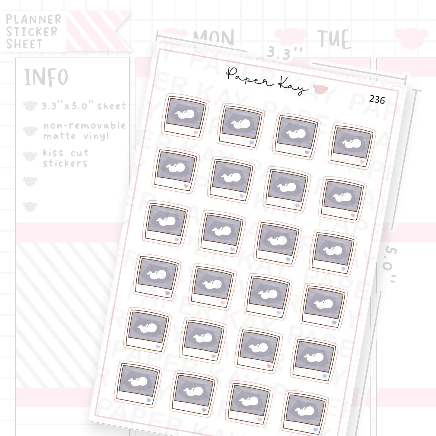 Sonogram/Ultrasound Picture Sticker Sheet